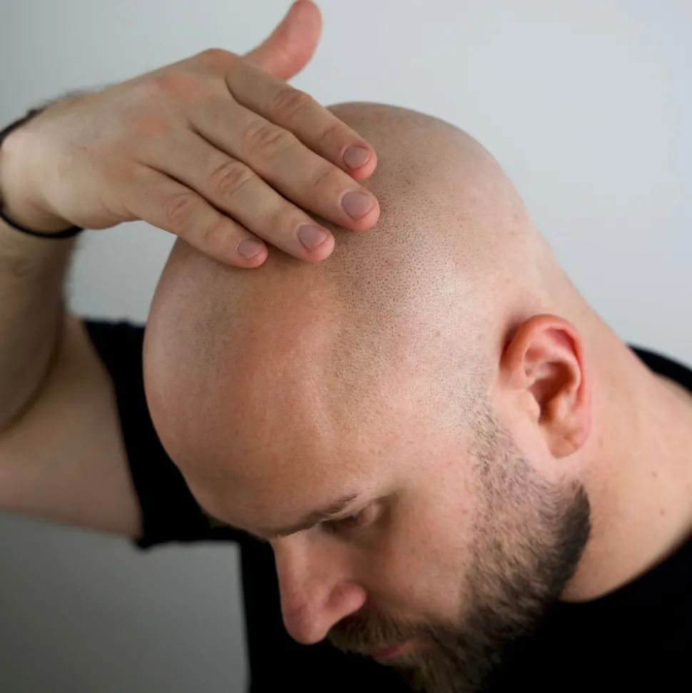 Magic Bald Head & Beard Oil 30ml